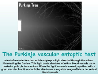 The Purkinje vascular entoptic test
a test of macular function which employs a light directed through the sclera
illuminating the fundus. This light casts shadows of retinal blood vessels on to
posterior pole photoreceptors. When the light source is moved, a patient with a
good macular function should be able to see a negative image of his or her retinal
blood vessels
 