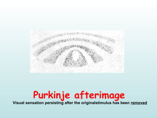 Purkinje afterimage
Visual sensation persisting after the originalstimulus has been removed
 