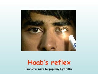 Haab’s reflex
Is another name for pupillary light reflex
 