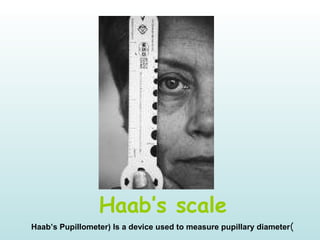 Haab’s scale
)Haab’s Pupillometer) Is a device used to measure pupillary diameter
 