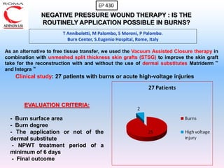 NEGATIVE PRESSURE WOUND THERAPY : IS THE
ROUTINELY APPLICATION POSSIBLE IN BURNS?
T Anniboletti, M Palombo, S Moroni, P Palombo.
Burn Center, S.Eugenio Hospital, Rome, Italy
EP 430
As an alternative to free tissue transfer, we used the Vacuum Assisted Closure therapy in
combination with unmeshed split thickness skin grafts (STSG) to improve the skin graft
take for the reconstruction with and without the use of dermal substitutes Matriderm ™
and Integra ™
EVALUATION CRITERIA:
- Burn surface area
- Burn degree
- The application or not of the
dermal substitute
- NPWT treatment period of a
minimum of 6 days
- Final outcome
Clinical study: 27 patients with burns or acute high-voltage injuries
 