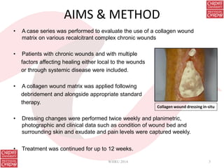 AIMS & METHOD
• A case series was performed to evaluate the use of a collagen wound
matrix on various recalcitrant complex chronic wounds
• Patients with chronic wounds and with multiple
factors affecting healing either local to the wounds
or through systemic disease were included.
• A collagen wound matrix was applied following
debridement and alongside appropriate standard
therapy.
• Dressing changes were performed twice weekly and planimetric,
photographic and clinical data such as condition of wound bed and
surrounding skin and exudate and pain levels were captured weekly.
• Treatment was continued for up to 12 weeks.
WHRU 2014 3
Collagen wound dressing in-situ
 