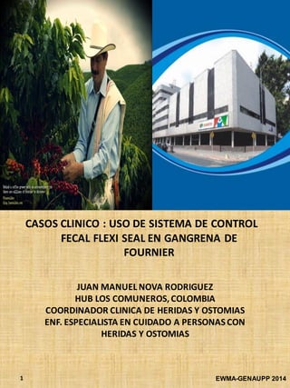 JUAN MANUEL NOVA RODRIGUEZ
HUB LOS COMUNEROS, COLOMBIA
COORDINADOR CLINICA DE HERIDAS Y OSTOMIAS
ENF. ESPECIALISTA EN CUIDADO A PERSONAS CON
HERIDAS Y OSTOMIAS
CASOS CLINICO : USO DE SISTEMA DE CONTROL
FECAL FLEXI SEAL EN GANGRENA DE
FOURNIER
EWMA-GENAUPP 20141
 