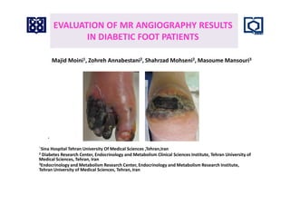 EVALUATION OF MR ANGIOGRAPHY RESULTS
IN DIABETIC FOOT PATIENTS
Majid Moini�, Zohreh Annabestani�, Shahrzad Mohseni�, Masoume Mansouri�
•
Sina Hospital Tehran University Of Medical Sciences ,Tehran,Iran
� Diabetes Research Center, Endocrinology and Metabolism Clinical Sciences Institute, Tehran University of
Medical Sciences, Tehran, Iran
�Endocrinology and Metabolism Research Center, Endocrinology and Metabolism Research Institute,
Tehran University of Medical Sciences, Tehran, Iran
 