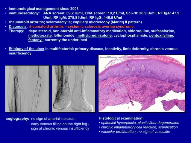 EWMA 2013 - Ep519 - DIFFERENTIAL DIAGNOSIS OF LEG ULCERS - ULCERS OF ...