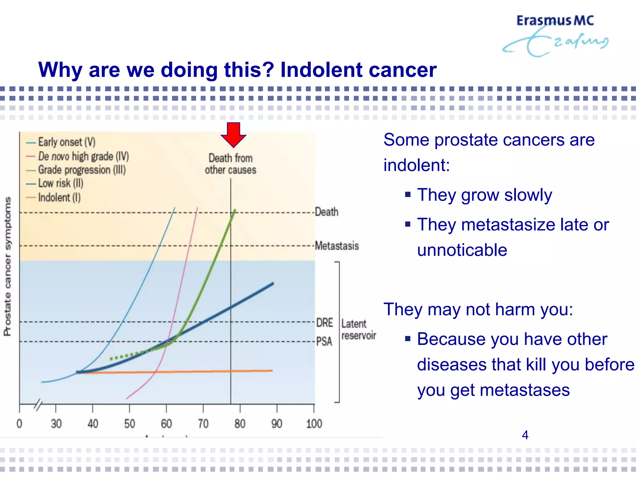 Active Surveillance for Prostate Cancer | PDF