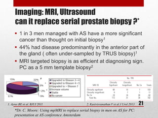 Active Surveillance for Prostate Cancer | PDF