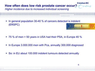 Active Surveillance for Prostate Cancer | PDF