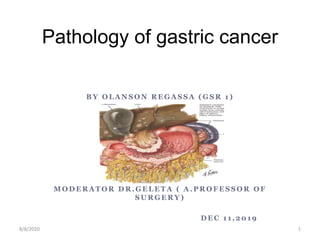 Pathology of gastric cancer
B Y O L A N S O N R E G A S S A ( G S R 1 )
M O D E R A T O R D R . G E L E T A ( A . P R O F E S S O R O F
S U R G E R Y )
D E C 1 1 , 2 0 1 9
8/8/2020 1
 