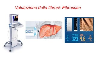 Valutazione della fibrosi: Fibroscan
 