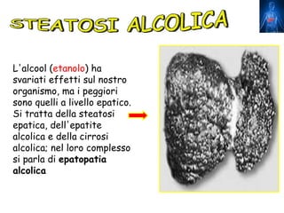 L'alcool (etanolo) ha
svariati effetti sul nostro
organismo, ma i peggiori
sono quelli a livello epatico.
Si tratta della steatosi
epatica, dell'epatite
alcolica e della cirrosi
alcolica; nel loro complesso
si parla di epatopatia
alcolica
 