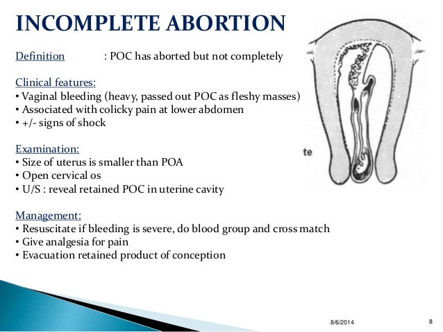 the definition of abortion Publications and journal articles related to unsafe abortion including global and regional estimates of the incidence of unsafe abortion and associated mortality. the definition of abortion Publications and journal articles related to unsafe abortion including global and regional estimates of the incidence of unsafe abortion and associated mortality.