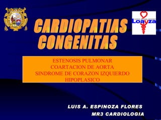 LUIS A. ESPINOZA FLORES  MR3 CARDIOLOGIA CARDIOPATIAS  CONGENITAS ESTENOSIS PULMONAR COARTACION DE AORTA SINDROME DE CORAZON IZQUIERDO HIPOPLASICO 