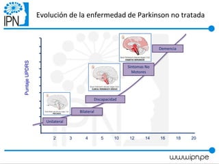 Evolución de la enfermedad de Parkinson no tratada
PuntajeUPDRS
2 3 4 5 10 12 14 16 18 20
Unilateral
Bilateral
Discapacidad
Sintomas No
Motores
Demencia
 