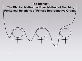 1414
The Blanket
The Blanket Method: a Novel Method of Teaching
Peritoneal Relations of Female Reproductive Organs
 