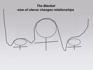 1515
The Blanket
-size of uterus changes relationships-
 