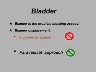 ★ Bladder is the problem blocking access!
★ Bladder displacement:
• Supravesical approach
• Paravesical approach
Bladder
 