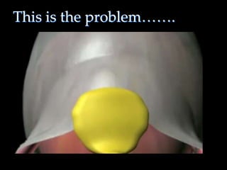 This is the problem…….
25
 