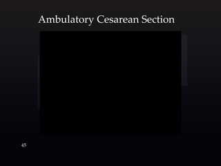 4545
Ambulatory Cesarean Section
 