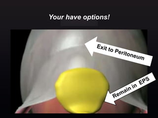 Your have options!
48
 