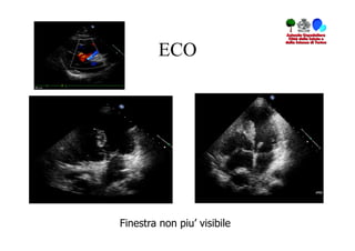 ECO




Finestra non piu’ visibile
 