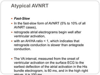 Ep diagnosis and ablation of avnrt | PPTX