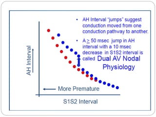 Ep diagnosis and ablation of avnrt | PPTX