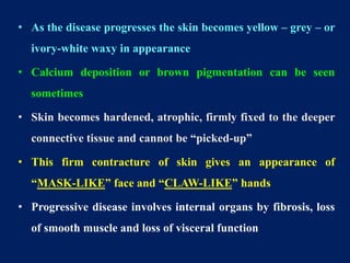 • As the disease progresses the skin becomes yellow – grey – or
ivory-white waxy in appearance
• Calcium deposition or brown pigmentation can be seen
sometimes
• Skin becomes hardened, atrophic, firmly fixed to the deeper
connective tissue and cannot be “picked-up”
• This firm contracture of skin gives an appearance of
“MASK-LIKE” face and “CLAW-LIKE” hands
• Progressive disease involves internal organs by fibrosis, loss
of smooth muscle and loss of visceral function
 
