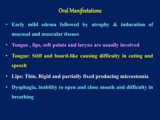 • Early mild edema followed by atrophy & induration of
mucosal and muscular tissues
• Tongue , lips, soft palate and larynx are usually involved
• Tongue: Stiff and board-like causing difficulty in eating and
speech
• Lips: Thin, Rigid and partially fixed producing microstomia
• Dysphagia, inability to open and close mouth and difficulty in
breathing
Oral Manifestations
 