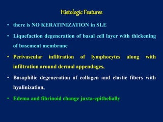 • there is NO KERATINIZATION in SLE
• Liquefaction degeneration of basal cell layer with thickening
of basement membrane
• Perivascular infiltration of lymphocytes along with
infiltration around dermal appendages,
• Basophilic degeneration of collagen and elastic fibers with
hyalinization,
• Edema and fibrinoid change juxta-epithelially
Histologic Features
 