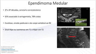 • 3º e 4º décadas, cervical e cervicotorácico
• 65% associado à seringomielia, 78% cistos
• Escoliose, erosão pedicular e do corpo vertebral ao RX
• Sinal Hipo ou isointenso em T1 e Hiper em T2
Ependimoma Medular
 