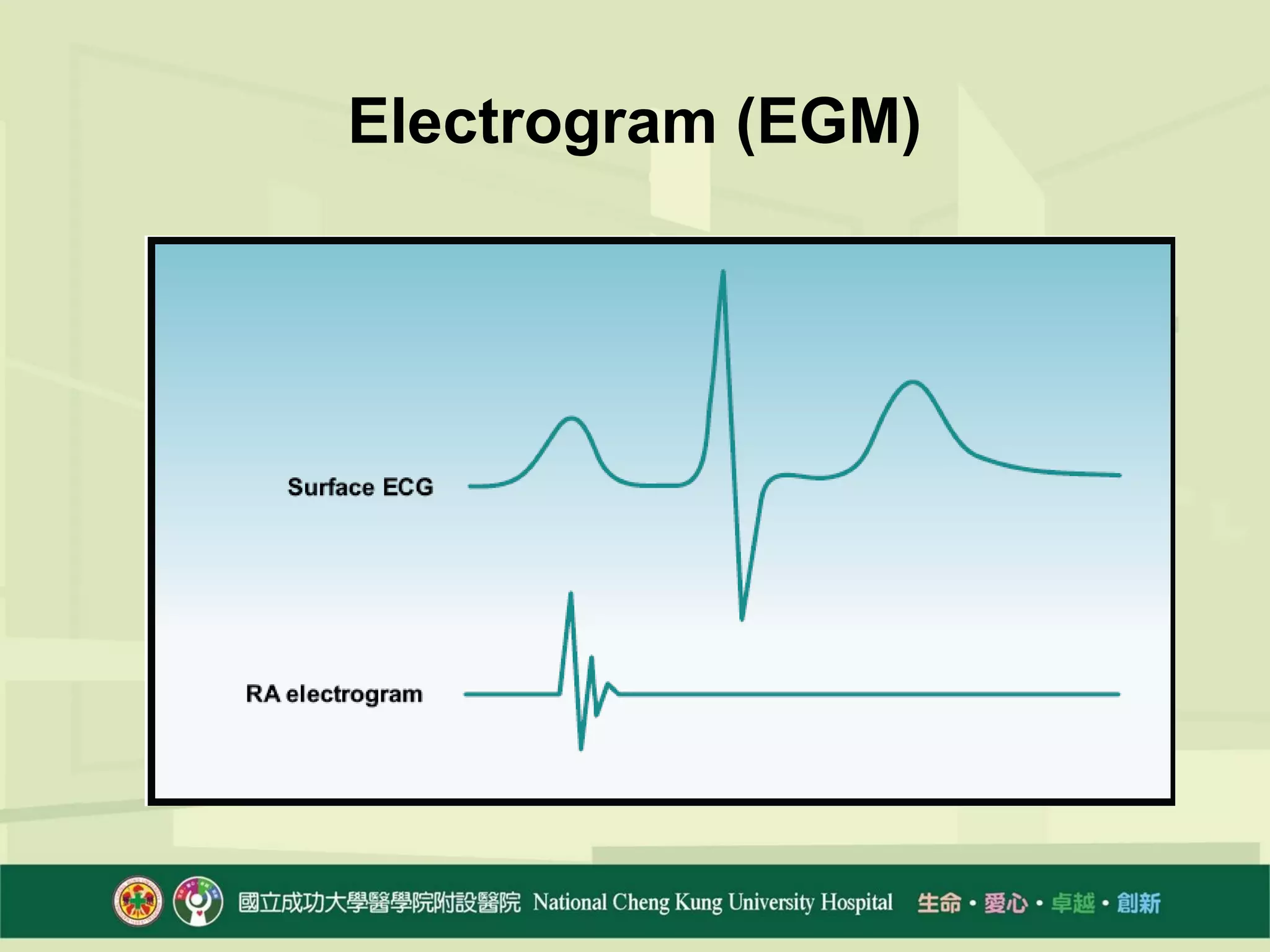 EPS 的基本設定_20120916_南區| PPT