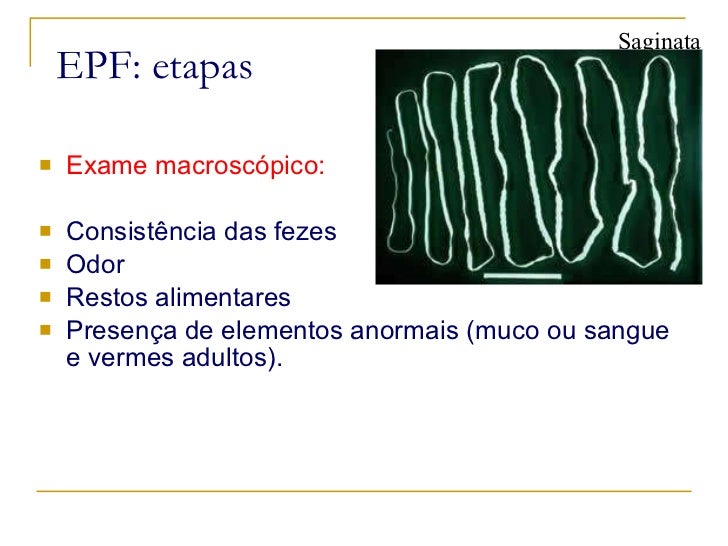 Epf exame