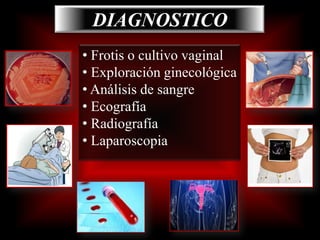 Término de embarazo