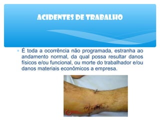 Acidentes de trabalho

∗ É toda a ocorrência não programada, estranha ao
andamento normal, da qual possa resultar danos
físicos e/ou funcional, ou morte do trabalhador e/ou
danos materiais econômicos a empresa.

 