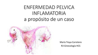 ENFERMEDAD PELVICA
INFLAMATORIA
a propósito de un caso
María Troya Carretero
R3 Ginecología HCS
 