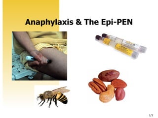 1/1
Anaphylaxis & The Epi-PEN
 