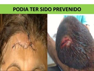 PODIA TER SIDO PREVENIDO
 