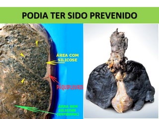PODIA TER SIDO PREVENIDO
 