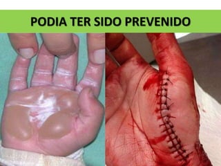 PODIA TER SIDO PREVENIDO
 