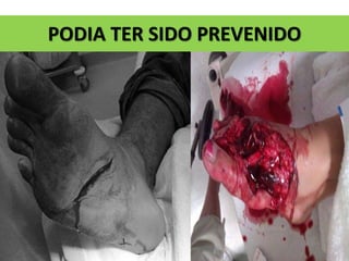 PODIA TER SIDO PREVENIDO
 