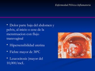 Enfermedad Pélvica Inflamatoria Dolor parte baja del abdomen y pelvis, al inicio o cese de la menstruacion con flujo transvaginal Hipersensibilidad uterina Fiebre mayor de 38ªC Leucocitosis (mayor del 10,000/mcL 