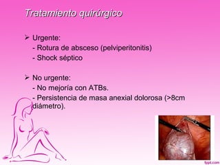 Tratamiento quirúrgico

 Urgente:
  - Rotura de absceso (pelviperitonitis)
  - Shock séptico

 No urgente:
  - No mejoría con ATBs.
  - Persistencia de masa anexial dolorosa (>8cm
  diámetro).
 