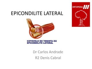 EPICONDILITE LATERAL Dr Carlos Andrade R2 Denis Cabral 