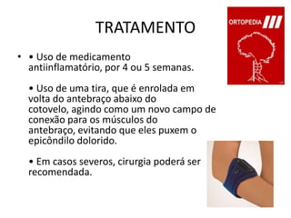 TRATAMENTO• Uso de medicamento antiinflamatório, por 4 ou 5 semanas.• Uso de uma tira, que é enrolada em volta do antebraço abaixo do cotovelo, agindo como um novo campo de conexão para os músculos do antebraço, evitando que eles puxem o epicôndilo dolorido.• Em casos severos, cirurgia poderá ser recomendada.
