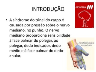 INTRODUÇÃOA síndrome do túnel do carpo é causada por pressão sobre o nervo mediano, no punho. O nervo mediano proporciona sensibilidade à face palmar do polegar, ao polegar, dedo indicador, dedo médio e à face palmar do dedo anular.