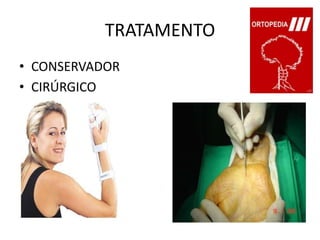TRATAMENTOCONSERVADOR CIRÚRGICO