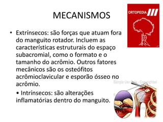 MECANISMOSExtrínsecos: são forças que atuam fora do manguito rotador. Incluem as características estruturais do espaço subacromial, como o formato e o tamanho do acrômio. Outros fatores mecânicos são os osteófitosacrômioclavicular e esporão ósseo no acrômio.    • Intrínsecos: são alterações inflamatórias dentro do manguito.