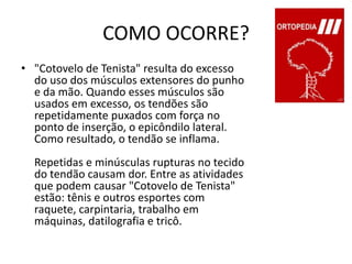 COMO OCORRE?"Cotovelo de Tenista" resulta do excesso do uso dos músculos extensores do punho e da mão. Quando esses músculos são usados em excesso, os tendões são repetidamente puxados com força no ponto de inserção, o epicôndilo lateral. Como resultado, o tendão se inflama.Repetidas e minúsculas rupturas no tecido do tendão causam dor. Entre as atividades que podem causar "Cotovelo de Tenista" estão: tênis e outros esportes com raquete, carpintaria, trabalho em máquinas, datilografia e tricô.