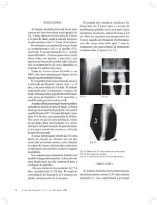 16 R. Into, Rio de Janeiro, v. 2, n. 3, p. 1-60, set/dez. 2004
RESULTADOS
As fraturas da diáfise femoral foram mais
comuns no sexo masculino, na proporção de
2:1. Afaixaetáriaenvolvidavarioude8meses
a 10 anos de idade, sendo a maioria dos casos
empré-escolaresentre2e5anos(9pacientes).
Osprincipaismecanismosdetraumaforam
os atropelamentos (05) e as quedas (05),
ocorrendo 1 caso de trauma direto e 1 colisão
automobilística. Fraturas associadas foram
observadas em apenas 1 paciente, que
apresentou fraturas de costelas e da clavícula.
Não ocorreram lesões de outros aparelhos ou
sistemas em nenhum dos casos.
Todas as fraturas foram fechadas e em
100% dos casos apresentaram algum desvio
angularouencurtamentoiniciais.
O tempo decorrido entre o trauma inicial e
a admissão no Hospital variou entre 1 e 19
dias, com uma média de 9,8 dias. O método
empregado para o tratamento consistiu em
traçãotransesqueléticaseguidadeimobilização
com gesso pevipodálico em 8 pacientes, e
imobilizaçãogessadaimediataem4.
Atécnicautilizadaparatraçãotransenquelética
consistiunainserçãodopinodetraçãonofêmur
distaleposicionamentodopacientecomquadril
ejoelhofletidosa90°. Otempodetraçãovariou
entre 14 e 26 dias, com uma média de 20 dias.
Nos casos em que foi utilizada tração, foram
necessárias duas intervenções no centro
cirúrgico,umaparainserçãodopinodetração
e outra para retirada do mesmo e confecção
de aparelho gessado.
A única complicação observada foi uma
úlcera de pressão no calcâneo em um dos
casos, não ocorrendo outras, como infecção
notrajetodospinos,refratura,discrepânciano
comprimentodosmembrosoudesvioangular
inaceitáveis.
Noscasosemqueotratamentofoifeitocom
imobilizaçãogessadaimediata,sófoirealizada
uma intervenção na sala operatória para a
confecção do aparelho.
O tempo médio de internação foi de 17,4
dias, variando entre 2 e 29 dias. O tempo de
consolidaçãodasfraturasfoide6semanasem
média, variando entre 4 e 8 semanas.
Dismetria dos membros inferiores foi
observada em 5 casos após a retirada da
imobilizaçãogessadaeem2casosapós2anos
do término do mesmo, todas inferiores a 2,0
cm. Desvios angulares estavam presentes em
5 casos quando da retirada da imobilização,
mas não foram observados após 2 anos de
tratamento, não necessitando de tratamento
complementar. ( Figuras 1,2 e 3 )
Fig. 01: Menino de 03 anos, tratamento conservador
Fig. 02: Sem dismetria residual,
Fig. 03: E sem desvios de eixo 02 anos após fratura.
DISCUSSÃO
As fraturas da diáfise femoral em crianças
são relativamente comuns (1,6% dos traumas
ortopédicos), mas representam a principal
Fig. 01 Fig. 02
Fig. 03
 